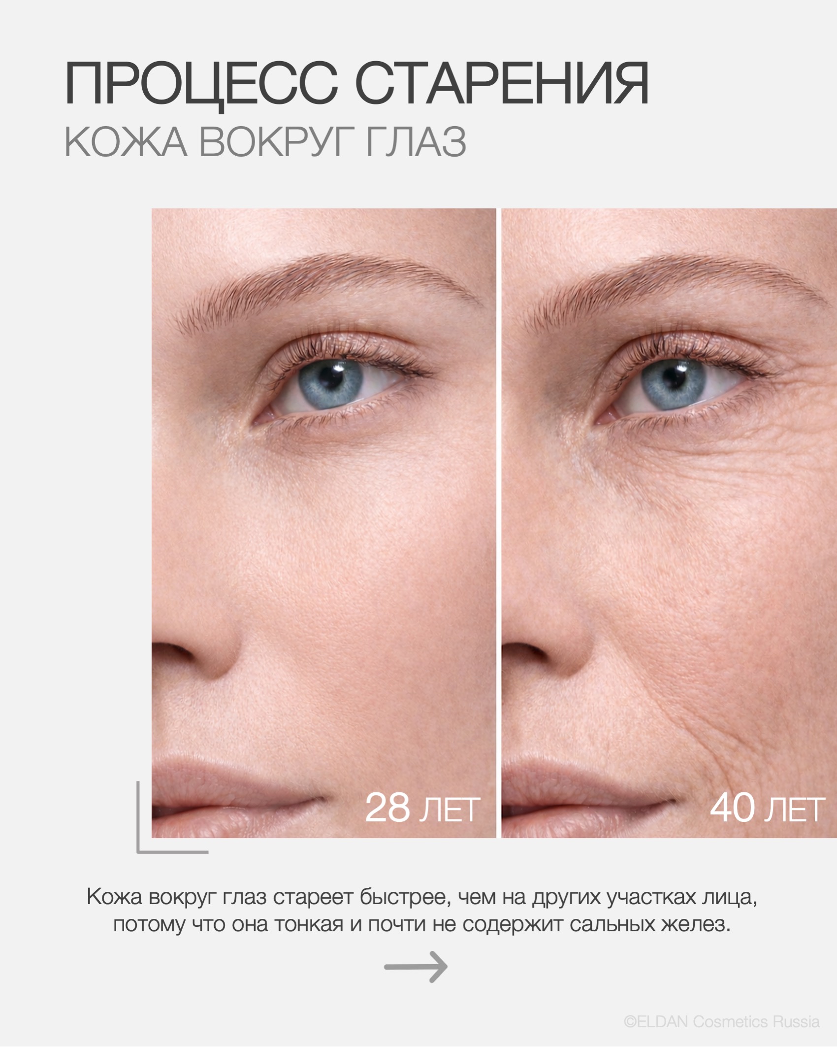 Пост старение кожи вокруг глаз 3.jpg Пост старение кожи вокруг глаз 3.jpg